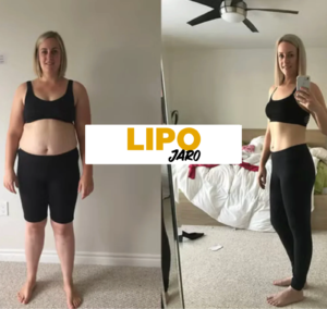 imgi_9_lipodep2-scaled-1.png